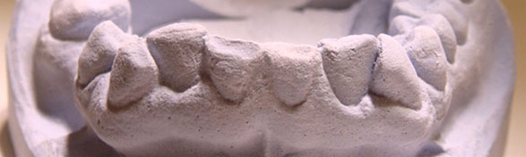 Crowding & abrasion