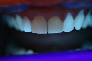 before with blacklight