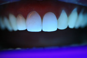 after with blacklight