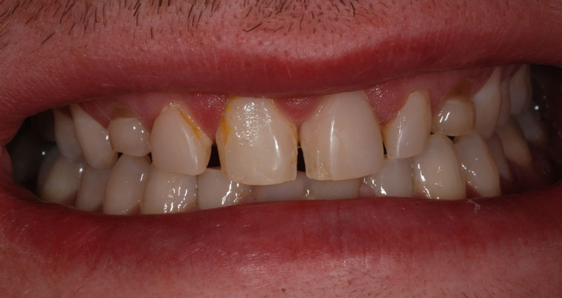 restore form & length