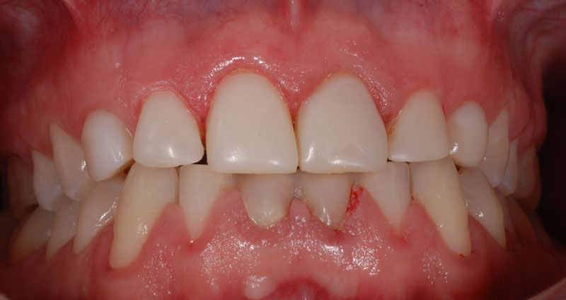 restore form & length