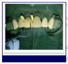 plaatje casus2